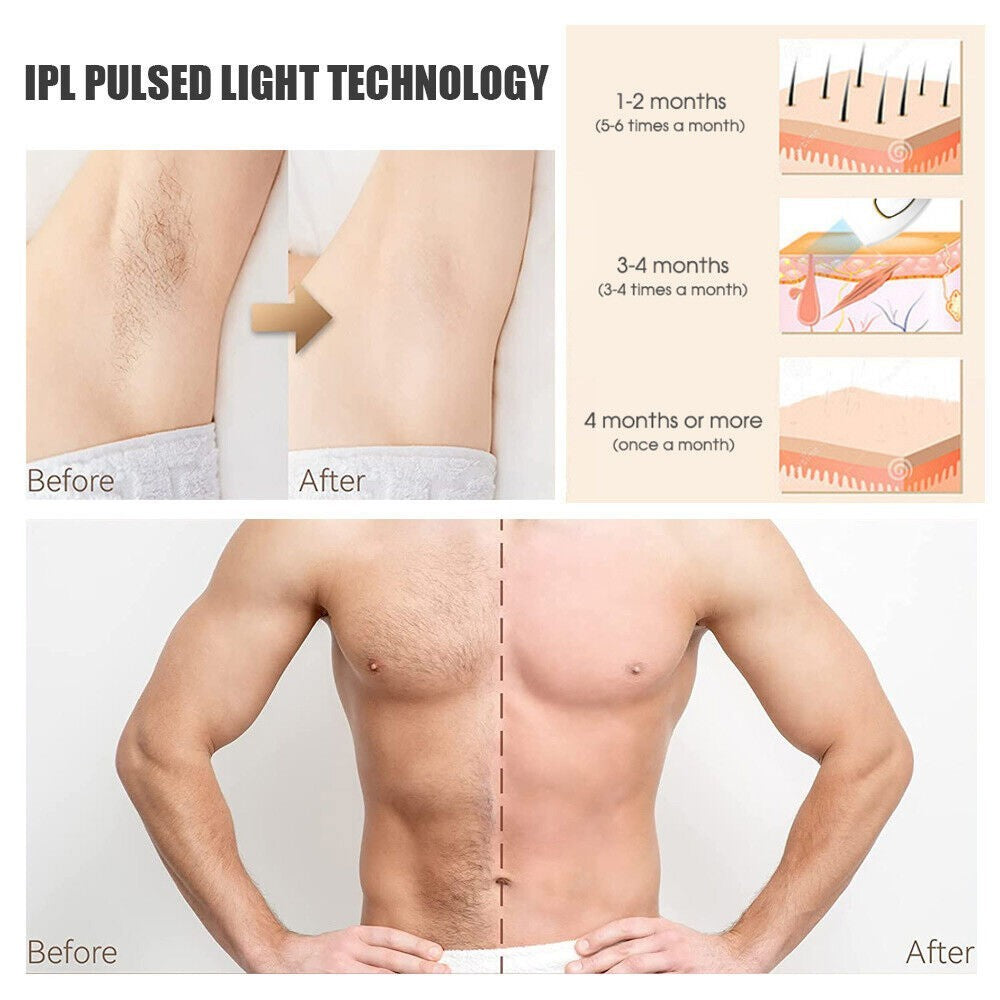 IPL Laser Permanent Hair Removal Device Painless Pulse Home Use